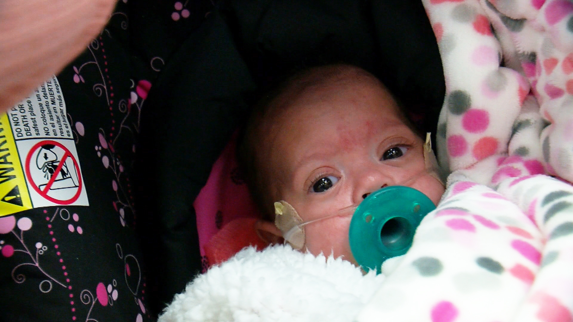 Baby Zara, A 'Micro-Preemie,' Finally Goes Home - WCCO ...