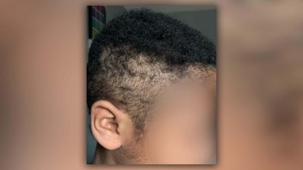 Teacher Cuts Black Student’s Hair Without Parents Permission [Video]